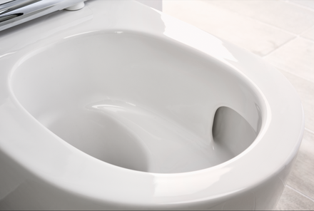 Quels sont les avantages du WC lavant ?